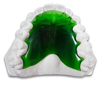Load image into Gallery viewer, Hawley Orthodontic Retainer,  Buy One Get One 30% Off BOGO! Use code: HAWLEY30 Save 20% Code: SPOOKY20