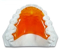 Load image into Gallery viewer, Hawley Orthodontic Retainer,  Buy One Get One 30% Off BOGO! Use code: HAWLEY30 Save 20% Code: SPOOKY20