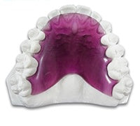Load image into Gallery viewer, Hawley Orthodontic Retainer,  Buy One Get One 30% Off BOGO! Use code: HAWLEY30
