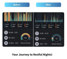 Load image into Gallery viewer, Sleep Apnea Sleep Appliance, Clear Retainer, Includes Connectors $65 value. Save 20% Code: SPOOKY20