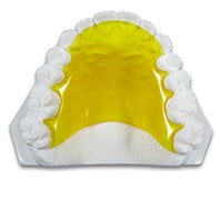 Load image into Gallery viewer, Hawley Orthodontic Retainer,  Buy One Get One 30% Off BOGO! Use code: HAWLEY30 Save 20% Code: SPOOKY20