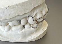 Load image into Gallery viewer, Hawley Orthodontic Retainer,  Buy One Get One 30% Off BOGO! Use code: HAWLEY30 Save 20% Code: SPOOKY20