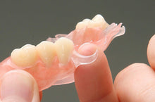 Load image into Gallery viewer, FLEXIBLE PARTIAL DENTURE. Premium teeth. www.theclearguard.com
