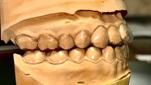 Load image into Gallery viewer, CLOSE UP OF CLEAR RETAINERS THECLEARGUARD.COM
