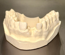 Load image into Gallery viewer, Partial Denture Clear Retainer, Includes 1 Tooth
