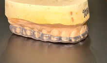 Load image into Gallery viewer, NightGuard teeth grinding