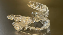 Load image into Gallery viewer, EMA SLEEP APNEA DEVICE. www.theclearguard.com
