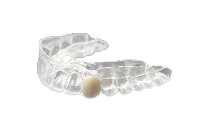 Clear Retainer Partial Denture with premium denture teeth. Clear Essix plastic is the best.