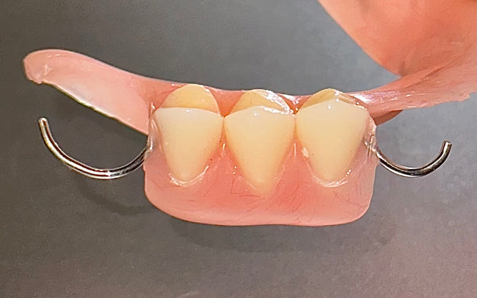 Removable partial denture premium teeth