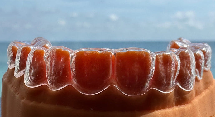 The Benefits of Wearing A Clear Retainer