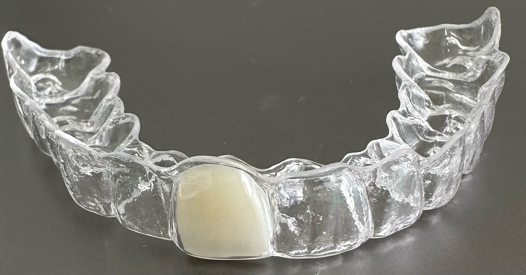 Partial Retainer The Clear Guard Essix Clear Retainer, Includes 1 Tooth