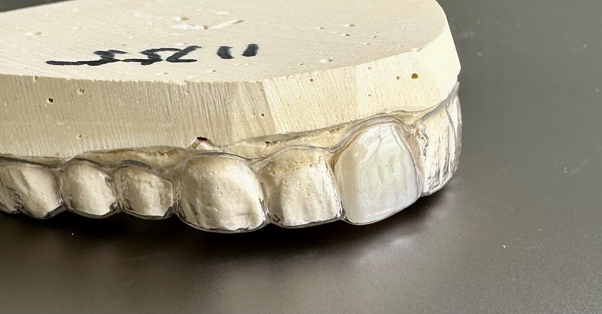 Partial Retainer The Clear Guard Essix Clear Retainer, Includes 1 Tooth