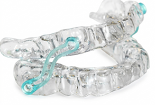 Load image into Gallery viewer, Sleep Apnea Sleep Appliance, Clear Retainer, Includes Variety Connectors
