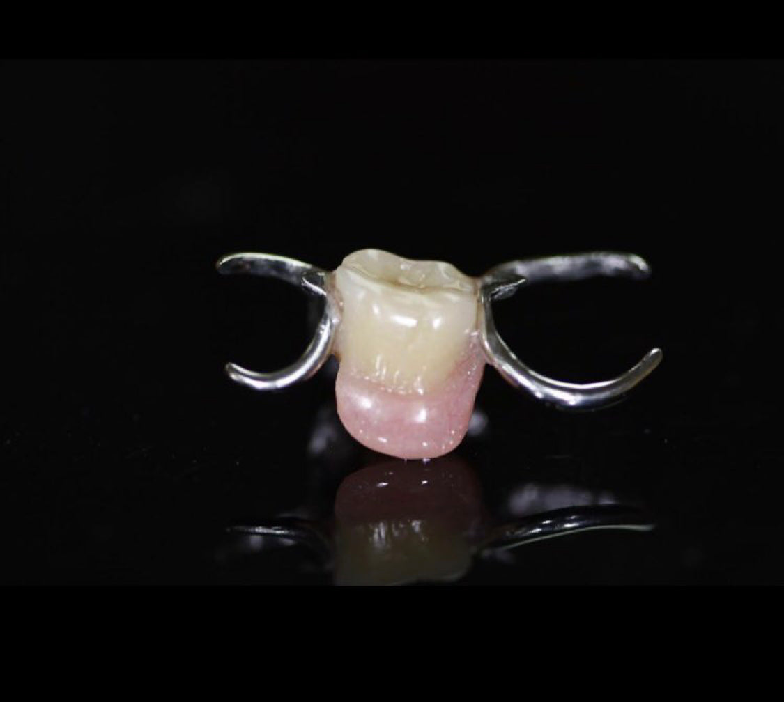 Dernture Rpd Flipper Acrylic Partial Denture, Flipper, Includes 1 Tooth, Save $37 with prom ...