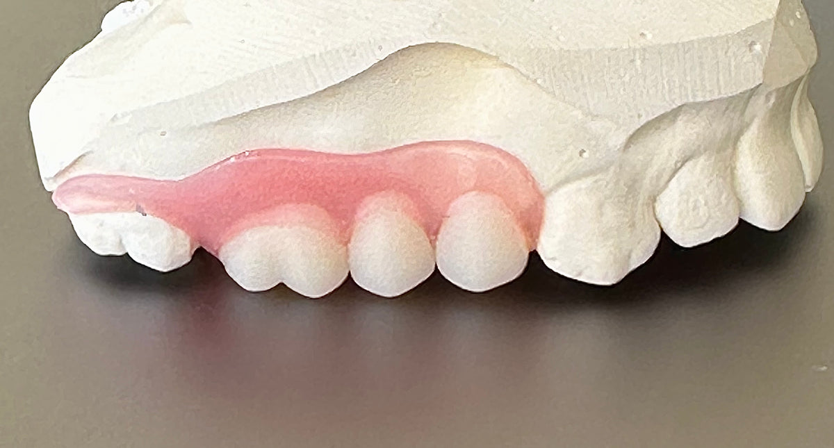 The Clear Guard Flexible Partial Denture, Includes 1 tooth