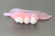 Load image into Gallery viewer, Flexible Partial Denture, Includes 1 tooth, Save $52 **** Use Code:TCG15 at checkout
