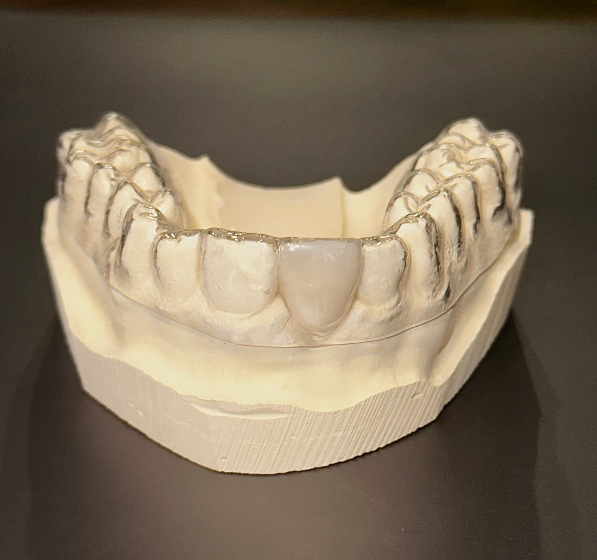 Partial Retainer Essix Clear Retainer, Includes 1 Tooth – The Clear Guard