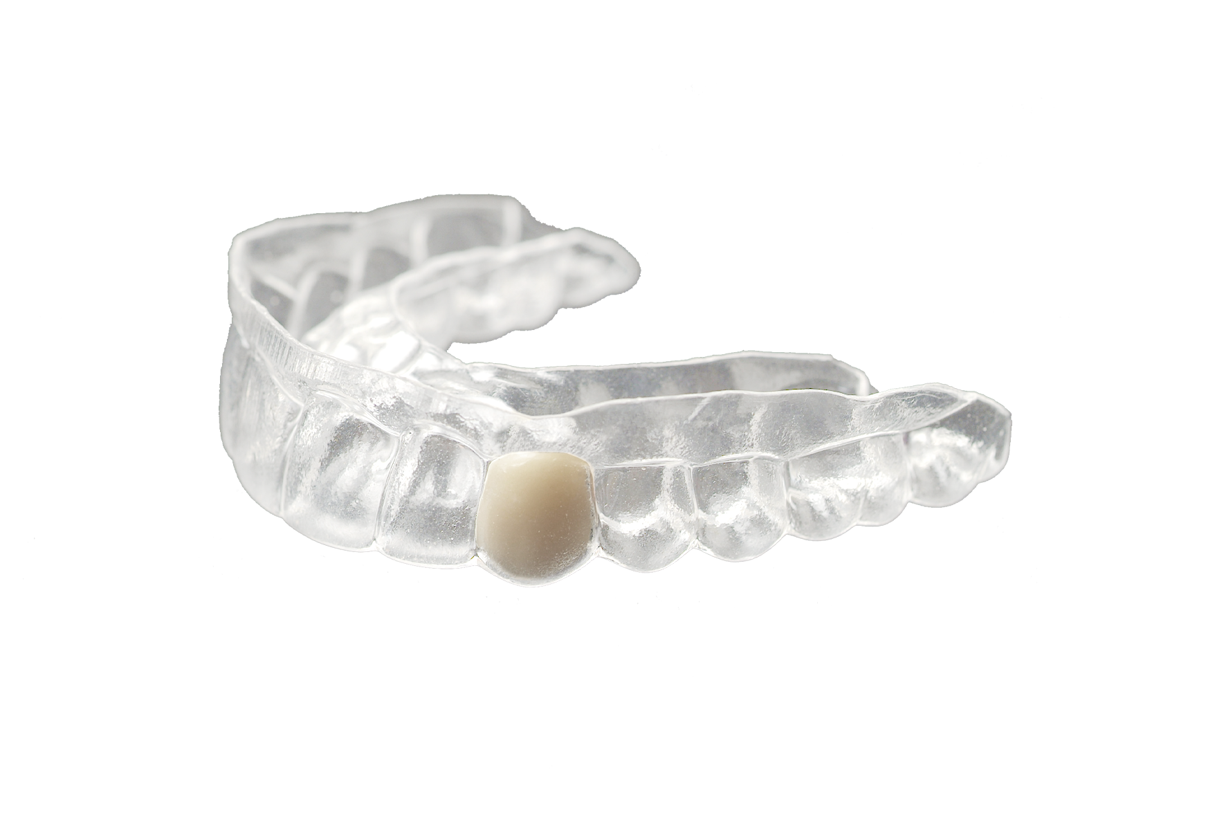 Partial Retainer Essix Clear Retainer, Includes 1 Tooth – The Clear Guard